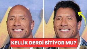 Kellik Tarihe mi Karışıyor? Bilim İnsanları Saçın Yeniden Uzamasını Sağlayan Serum Keşfetti