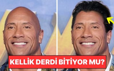 Kellik Tarihe mi Karışıyor? Bilim İnsanları Saçın Yeniden Uzamasını Sağlayan Serum Keşfetti