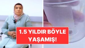 1.5 Yıldır Geçmeyen Öksürüğün Sebebi Şaşırttı: Akciğerine Kabak Çekirdeği Yapışan Hasta