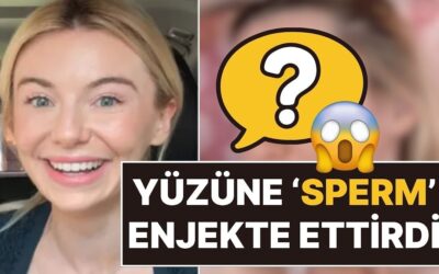 Estetikte Son Nokta: 31 Yaşındaki Televizyon Yıldızı Georgia Toffolo, Yüzüne Somon Spermi Enjekte Ettirdi