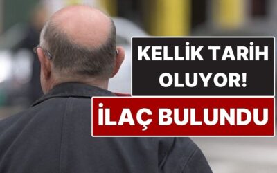 Kellik Tarih Olabilir! Erkek Tipi Kellik İçin Çığır Açan İlaç Bulundu