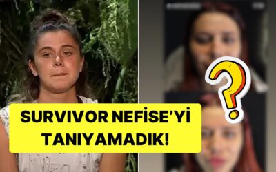 Estetik Yaptırmış! Survivor Nefise Karatay&apos;ın Dudak Dolgusu Gündem Oldu