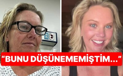 Tam Tamına 38 Kilo Verdi, Beklenmedik Yan Etki Yüzünden Estetik Operasyona Mahkum Oldu