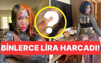 Estetik Operasyonlardan Önceki Halini Paylaşan Kadın &quot;Kendine Bu Kötülüğü Neden Yaptın?&quot; Dedirtti!