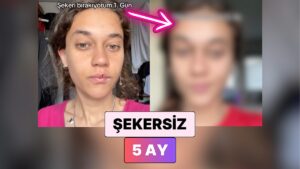 Şekeri Hayatından Tamamen Çıkaran Kadın 5 Ayda Yaşadığı Değişimi Paylaştı