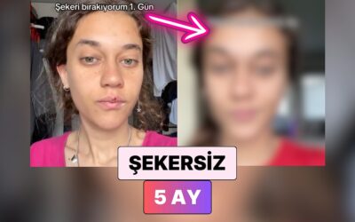 Şekeri Hayatından Tamamen Çıkaran Kadın 5 Ayda Yaşadığı Değişimi Paylaştı