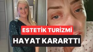 Ucuz Diye Türkiye’de 3 Bin Sterlinlik Diş Yaptırdı, Burnu Çöktü: Kimsenin Konuşmadığı O Risk Gerçek Oldu