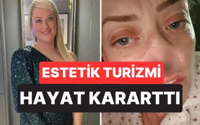 Ucuz Diye Türkiye’de 3 Bin Sterlinlik Diş Yaptırdı, Burnu Çöktü: Kimsenin Konuşmadığı O Risk Gerçek Oldu