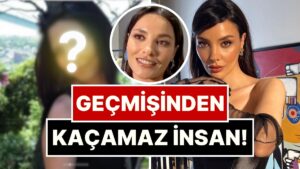 İnatla Yüzünde Bir Tane Bile Estetik Olmadığını İddia Eden Hazal Filiz Küçükköse&apos;nin Eski Hali