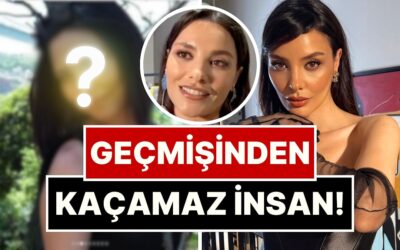 İnatla Yüzünde Bir Tane Bile Estetik Olmadığını İddia Eden Hazal Filiz Küçükköse&apos;nin Eski Hali