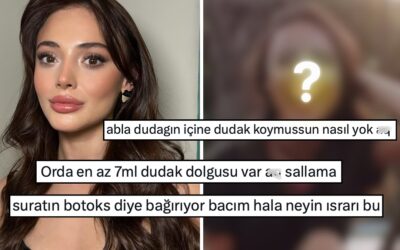 Eski Fotoğrafları Yeniden Dolaşıma Girdi: Estetik İşlemleri Yalanlamakta Israrcı Olan Rabia Soytürk Dile Düştü