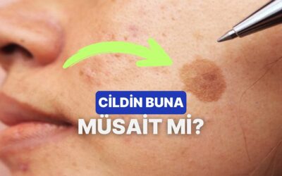 Leke Görünümüne Ne Kadar Yatkınsın?