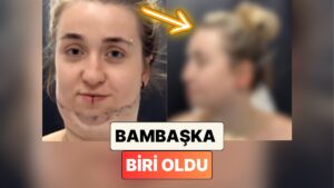 Geçirdiği Gıdı Operasyonunun Ardından Bambaşka Birine Dönüşen Kadının İnanılmaz Değişimi