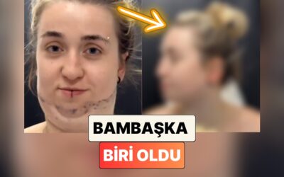Geçirdiği Gıdı Operasyonunun Ardından Bambaşka Birine Dönüşen Kadının İnanılmaz Değişimi