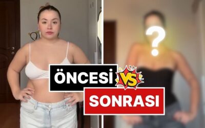 Genç Kadın, Kilo Verme Sürecinde Vücudunda Yaşadığı Şok Değişimi Paylaştı!