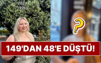 Bir Yıl İçinde 101 Kilo Veren Kadının Değişimi Gündem Oldu!