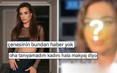 Estetik İddialarını Yalanlayan Bensu Soral&apos;ın Kameraya Yansıyan Yüz Hatları İnandırıcılığını Sorgulattı!