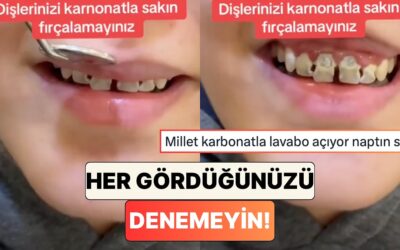 İnternette Her Gördüğünüzü Denemeyin! Bir Dişçi Dişini Karbonatla Fırçalayan Bir Hastanın Durumunu Paylaştı