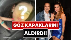 Muradına Erdi: Mehmet Ali Erbil&apos;İn Kendisinden 40 Yaş Küçük Eşi Gülseren Ceylan Estetik Yaptırdı!