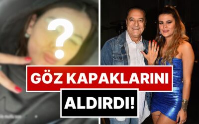 Muradına Erdi: Mehmet Ali Erbil&apos;İn Kendisinden 40 Yaş Küçük Eşi Gülseren Ceylan Estetik Yaptırdı!