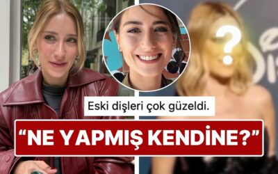 Yüzündeki Değişiklikle Son Hali Dikkat Çeken Hazal Kaya&apos;nın Dişlerine Yaptırdığı İşlem Sınıfta Kaldı