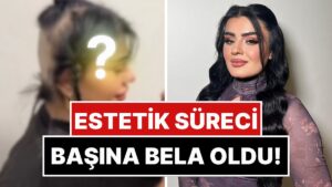 Estetik Sürecinde İçtiği İlaçlar Yüzünden Saçları Dökülen Hülya Mizgin, Son Halini Paylaştı!