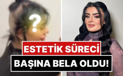 Estetik Sürecinde İçtiği İlaçlar Yüzünden Saçları Dökülen Hülya Mizgin, Son Halini Paylaştı!
