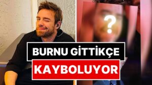 Artık Bitti Sanıyorduk: Burnuyla Derdi Bitmeyen Murat Dalkılıç&apos;ın 12. Kez Ameliyat Olduğu Ortaya Çıktı!