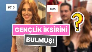 Gençlik İksirini Bulan Elçin Sangu'nun 1O Yılda Hiç Değişmeyen Güzelliği Sosyal Medyayı Salladı!