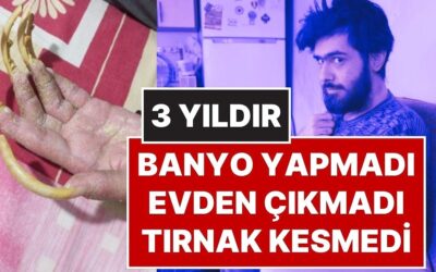 3 Yıldır Evden Çıkmadı, Banyo Yapmadı, Tırnak Kesmedi: 23 Yaşındaki Barış Oyun Bağımlısı Oldu