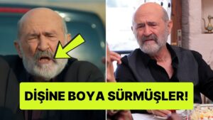 Uzak Şehir&apos;de Ecmel&apos;in Dişlerinin Nasıl Bu Kadar Sarı Olduğuna Diş Hekimi Açıklaması