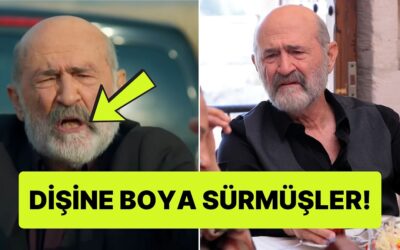 Uzak Şehir'de Ecmel'in Dişlerinin Nasıl Bu Kadar Sarı Olduğuna Diş Hekimi Açıklaması