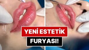 Yeni Estetik Trendi mi Doğuyor? &quot;Kalp Dudak&quot; Estetiği İçin Uygulanan Operasyon İçinizi Bi&apos; Tuhaf Yapacak!