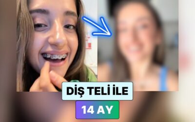 Diş Teli Taktıran Bir Kadın 14 Ayda Dişlerinin Geldiği Durumu Paylaştı