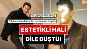 Son Haliyle Dikkat Çeken Kenan İmirzalıoğlu'nun Yüzüne Yaptırdığı Estetik İşlemler Göze Battı!