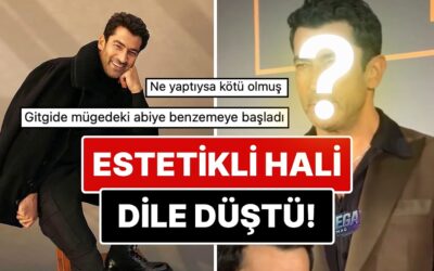 Son Haliyle Dikkat Çeken Kenan İmirzalıoğlu&apos;nun Yüzüne Yaptırdığı Estetik İşlemler Göze Battı!