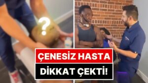 Çenesi Olmayan Bir Hastaya Kayroprakti Tedavisi Uygulayan Doktorun Profesyonelliği Beğeni Topladı
