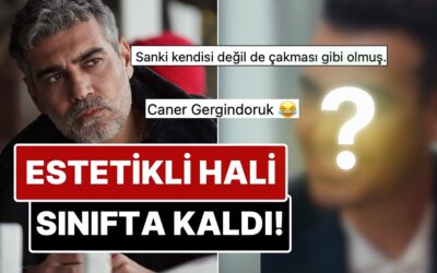 Saçlarını Boyatıp Dişlerini Yaptıran Caner Cindoruk&apos;un Estetikli Son Halini Görenler Tanımakta Zorlandı!