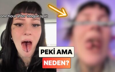 Dilini İkiye Böldüren Kadın İyileşme Sürecinde Yaşadıklarını Paylaştı