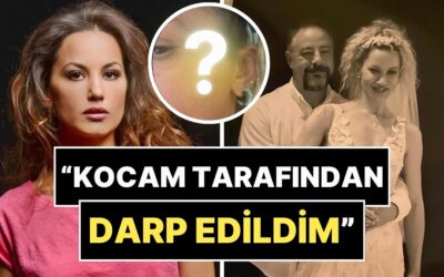 7 Ay Önce Evlenen Yıldız Asyalı, Eşi Tarafından Darp Edildiğini Duyurdu ve Fotoğraflarını Paylaştı!