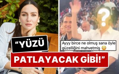 Estetik Dozu Kaçtı mı? Birce Akalay&apos;ın Yüzünün Son Halini Görenler Eski Doğallığıyla Karşılaştırmadan Edemedi!