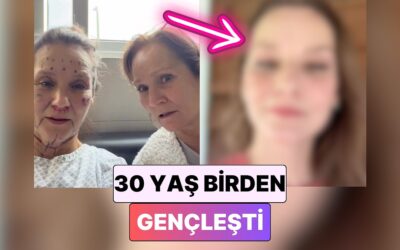 30 Yaş Gençleşti: Aynı Anda Birkaç Estetik Operasyon Geçiren Kadın İnanılmaz Değişimiyle Şaşırttı