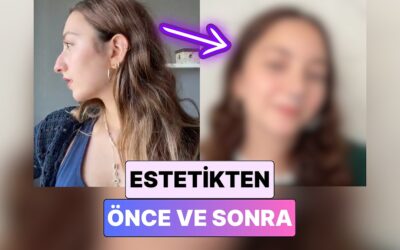 Burun Estetiği Nereye Gidiyor? Burun Estetiği Yaptıran Bir Kadın Yaşadığı Değişimi Paylaştı