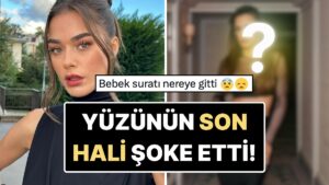 &quot;Eski Doğallığı Nereye Gitti?&quot; Paris Moda Haftası&apos;na Katılan Bensu Soral&apos;ın Yüzünün Son Hali Dikkat Çekti