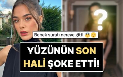 &quot;Eski Doğallığı Nereye Gitti?&quot; Paris Moda Haftası&apos;na Katılan Bensu Soral&apos;ın Yüzünün Son Hali Dikkat Çekti