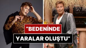 Yaklaşık 2 Aydır Yoğun Bakımda Tedavi Gören Fatih Ürek'in Bedeninde Yaralar Oluştu