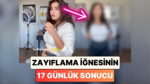 Zayıflama İğnesi Kullanmaya Başlayan Bir Kadın 17 Günde Yaşadığı Değişimi Paylaştı