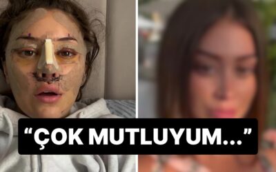 28 Yaşında Türkiye’de Yüz Germe Yaptıran Turistin Son Hali Gündem Oldu: “En İyi Versiyonum Oldum”