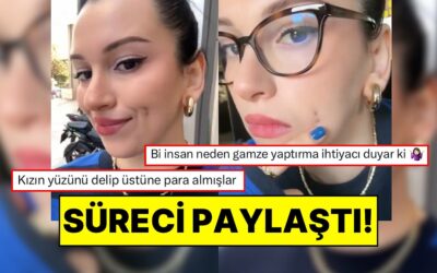 Gamze Estetiği Yaptıran Kadın İyileşme Sürecini Paylaştı: “Yüzünü Delip Para Almışlar”