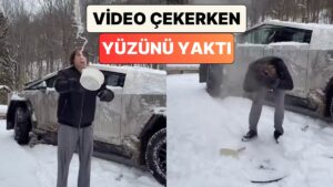 Bir Adam Soğuk Havada Sıcak Suyun Nasıl Kristalleştiğini Göstermek İsterken Yüzünü Yaktı